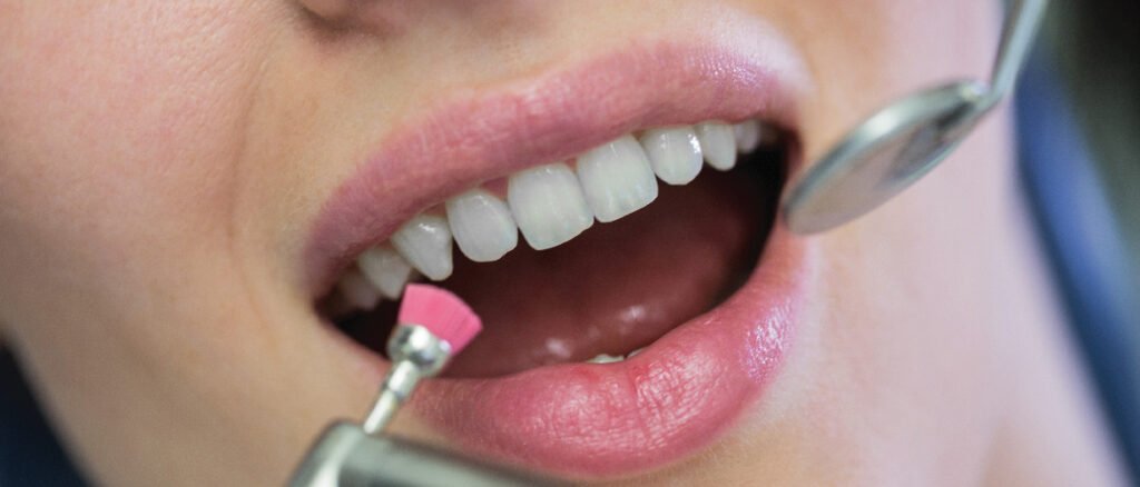 5 puntos clave para tener en cuenta a la hora de una ortodoncia